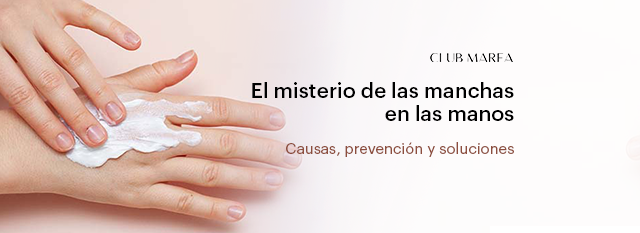 ¿Por qué salen manchas en las manos? Aprende 6 consejos para eliminarlas sin salir de casa