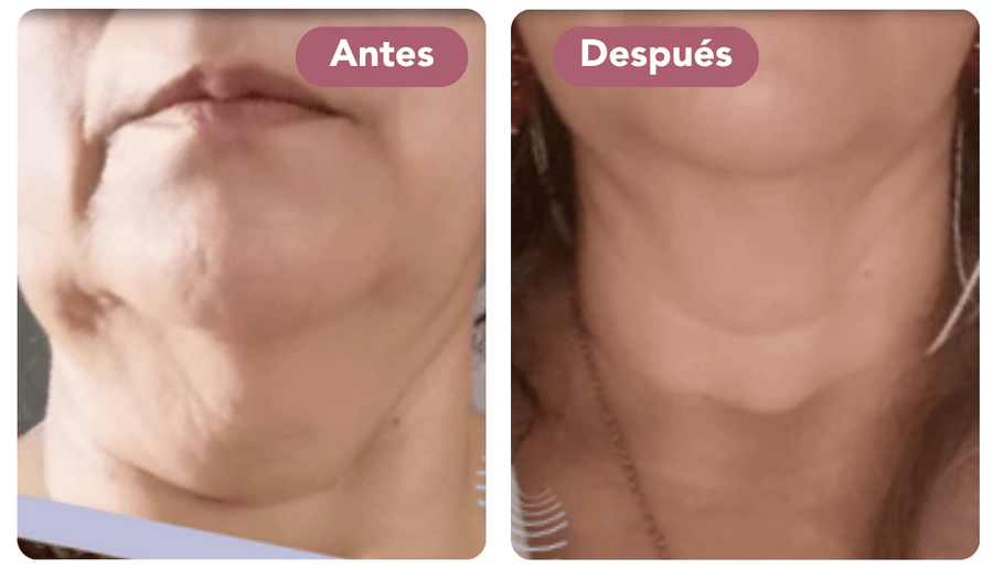 1 – Piel más firme y tonificada desde las primeras semanas