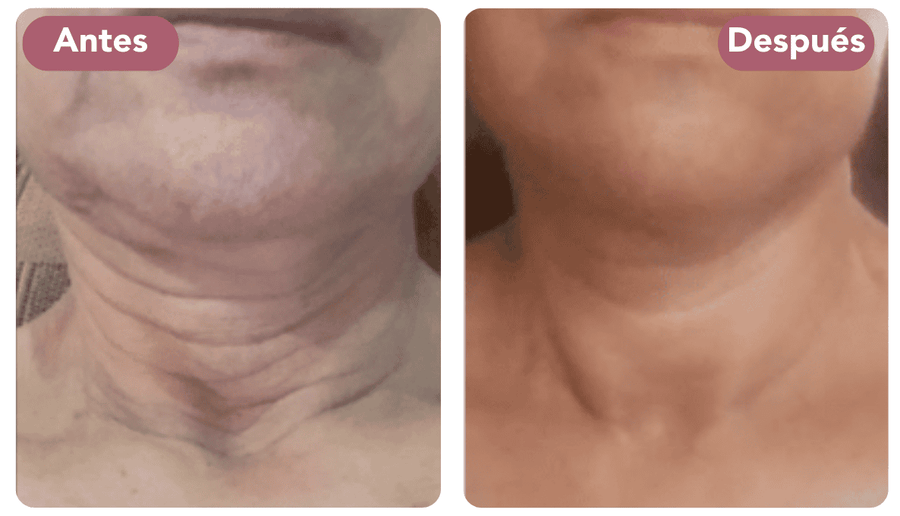 2 – Activa el rejuvenecimiento natural de tu piel