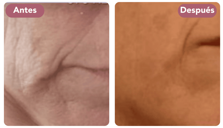 3 – Recupera tu brillo y confianza natural